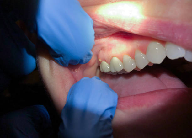 Best Pediatric Emergency Dentist in Tehachapi, CA